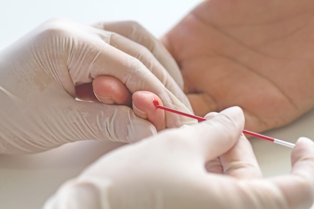 Le médecin a fait un test sanguin d' hématocrite à l' hôpital.