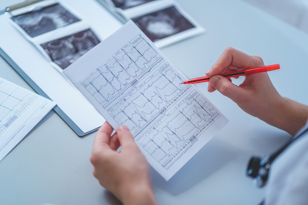 Le médecin généraliste examine l'électrocardiogramme du patient lors d'un bilan de santé et d'une consultation médicale. Diagnostic et traitement de la maladie