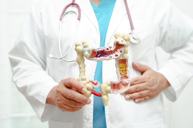 Médecin de l'intestin tenant un modèle d'anatomie pour le diagnostic et le traitement de l'étude à l'hôpital