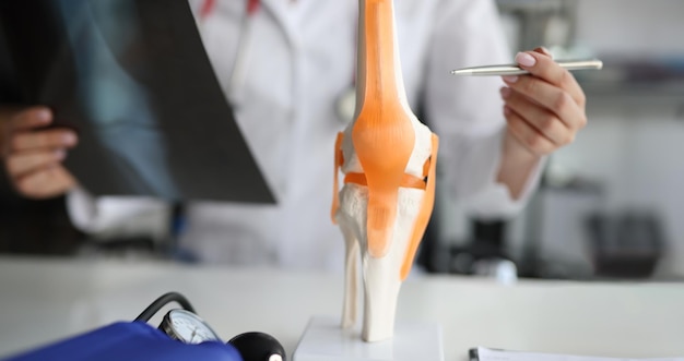 Photo le médecin montre l'anatomie de l'articulation du genou et la radiographie