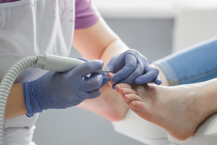 Photo médecin podiatre. traitement des pieds et des ongles.
