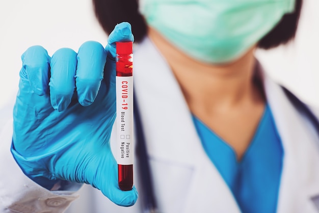 Photo un médecin scientifique en uniforme blanc porte un masque tenant un échantillon de sang de test de coronavirus tube à essai