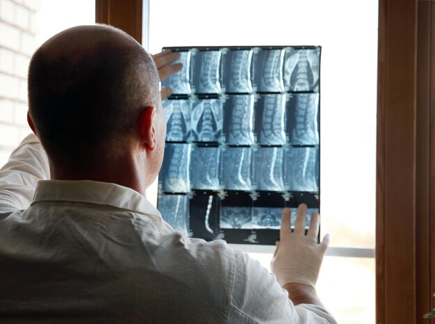 Un médecin de sexe masculin en blouse blanche et gants regarde les IRM de la colonne vertébrale dans la fenêtre