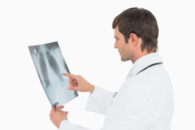 Médecin de sexe masculin concentré en regardant l&#39;image radiographique des poumons
