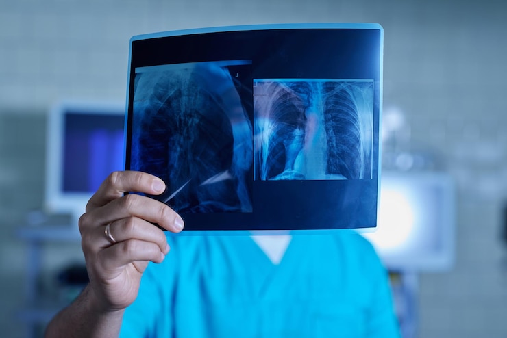 Photo le médecin tenant le résultat de la radiographie de près la machine d'échographie à ultrasons la mise au point sélective