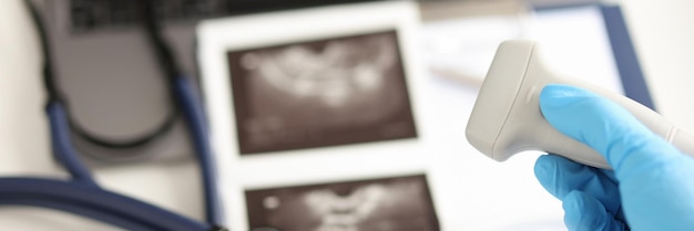 Photo médecin tenant une sonde à ultrasons sur fond d'images et de documents médicaux en gros plan