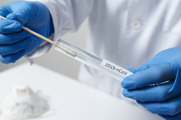 Médecin tenant un tube à essai sur écouvillon pour l'analyse 2019-nCoV. Test de coronavirus.