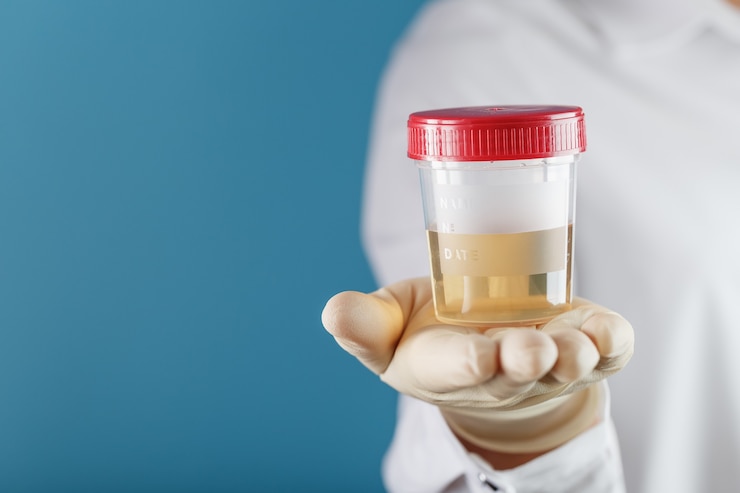Photo le médecin tient une boîte en plastique d'urine