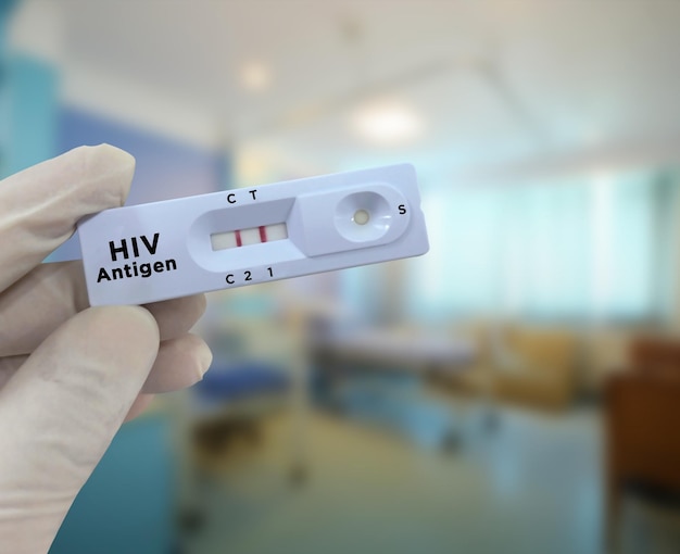 Le médecin tient une cassette de test rapide de résultat de test positif à l'antigène du VIH. séropositif