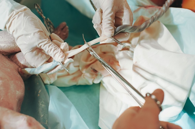 Photo un médecin tient le cordon ombilical d'un nouveau-né avec des clips et le père le coupe avec des ciseaux dans la maternité, la naissance du bébé.le concept de soins de santé.