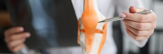 Le médecin traumatologue examine la radiographie et les jambes et le modèle d'articulation du genou