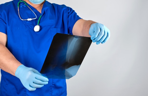 Médecin en uniforme bleu et gants en latex stériles retiennent et examinent la radiographie d&#39;un os de la jambe.