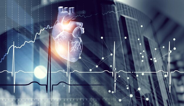 Médecine et technologie modernes. Cardiologie. Technique mixte