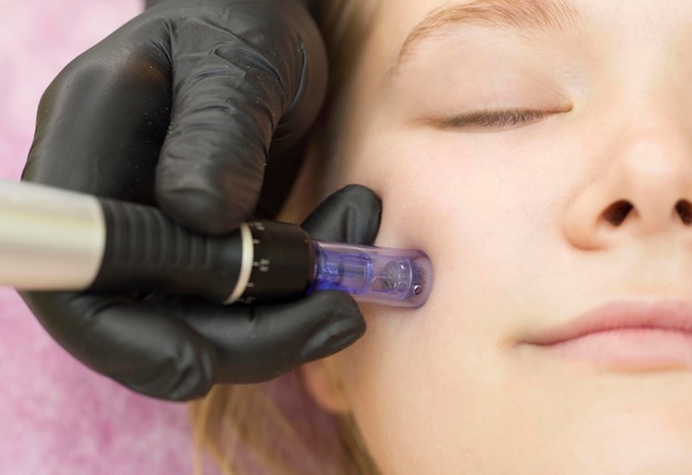 Mésothérapie à l'aiguille. Un cosmétologue effectue une mésothérapie à l'aiguille sur le visage d'une femme. Belle femme recevant un traitement de rajeunissement par microneedling. Levage de l'aiguille