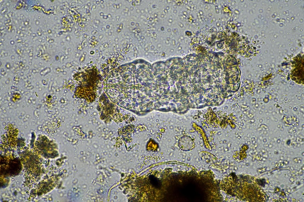 micro-organismes et un tardigrade dans un échantillon de sol dans une ferme