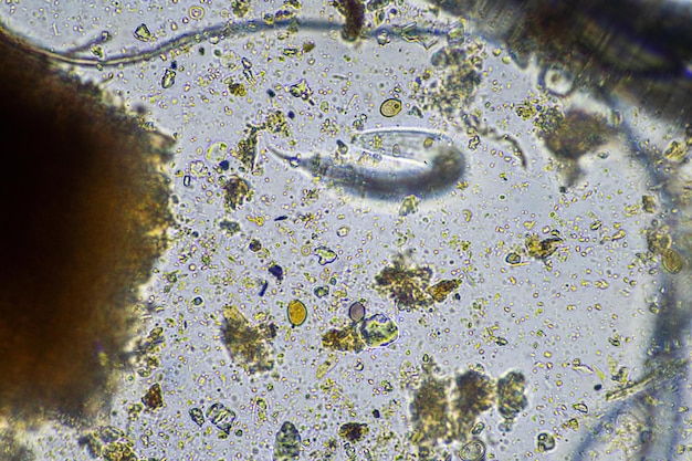 microbes du sol au microscope micro-organismes avec champignons dans le compost