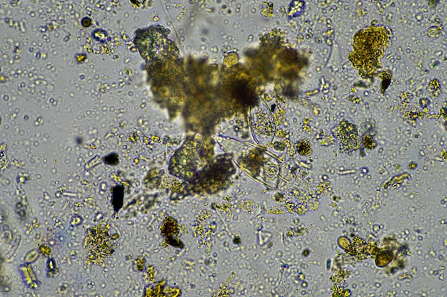 Photo microbes du sol au microscope micro-organismes avec champignons dans le compost