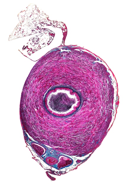 Photo micrographie du ductus deferens