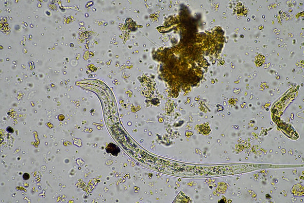 Microorganismes et biologie du sol avec nématodes et champignons sous le microscopex9