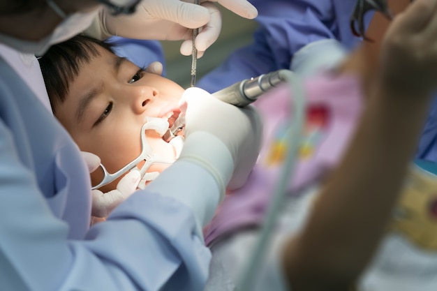 Mignon petit garçon asiatique assis dans le fauteuil dentaire et lui ouvrir la bouche avec un outil médical