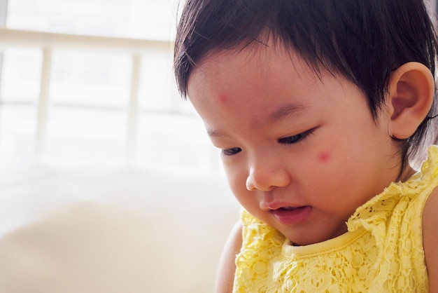 Mignonne petite fille asiatique avec une allergie au visage de tache rouge causée par une piqûre d'insecte