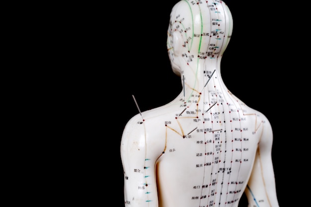 Modèle D'acupuncture Masculine Avec Des Aiguilles