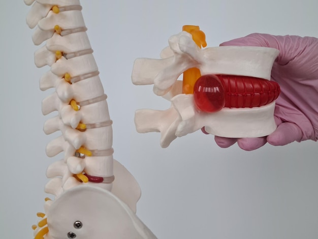 Photo modèle anatomique de la moelle épinière humaine et des vertèbres lombaires avec saillie pour l'enseignement médical