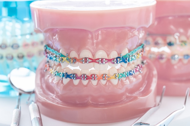 modèle de dents de démonstration des variétés de support orthodontique