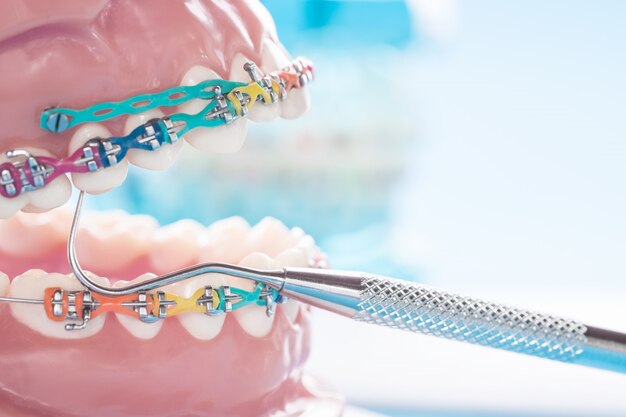 modèle de dents de démonstration des variétés de support orthodontique