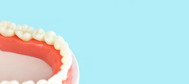 Modèle de dents dentaires prothèses dentaires sur fond bleu gros plan Des contrôles réguliers sont essentiels à la santé bucco-dentaire Outils orthodontiques Brace Bracket System Dent