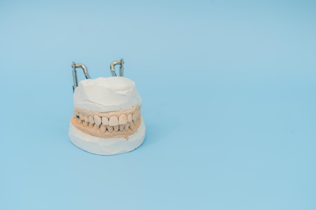Modèle d'enseignement de l'apprentissage de la dentisterie dentaire des dents montrant les racines des dents les gencives la maladie des gencives la carie dentaire et la plaque dentaire