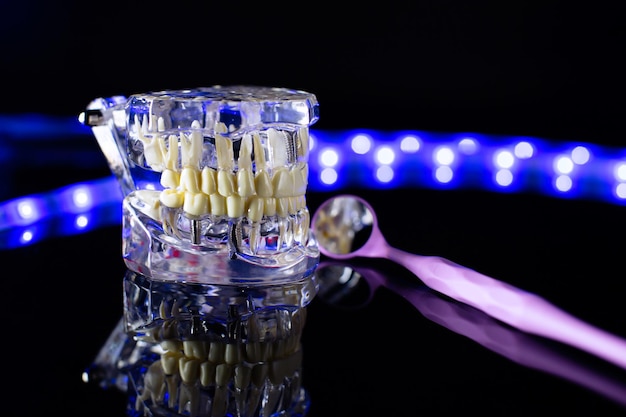 Photo modèle de mâchoire dentaire sur fond noir gouttières ou accolades dentaires invisibles transparentes applicables pour un traitement dentaire orthodontique