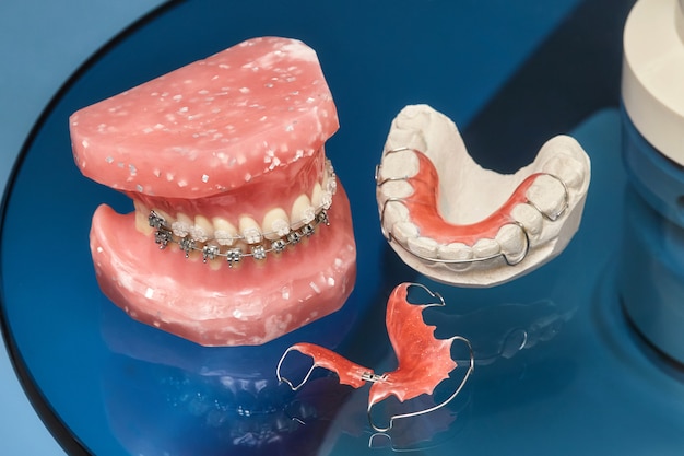 Modèle De Mâchoire Ou De Dents Humaines Avec Des Appareils Dentaires Métalliques