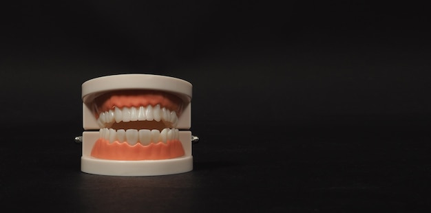 Modèle Orthodontique Des Dents Isolées Sur Fond Noir. Pour Les Soins Dentaires Et Aucun Peuple