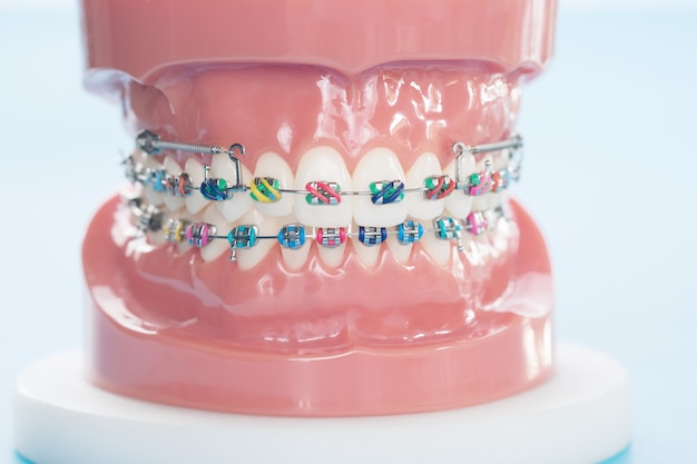 Modèle orthodontique et outil de dentiste - modèle de démonstration des dents