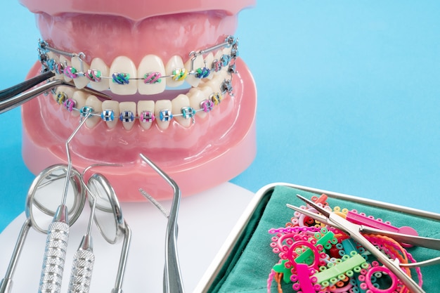 Modèle orthodontique et outil de dentiste - Modèle de dents de démonstration de variétés de brackets ou orthèses orthodontiques