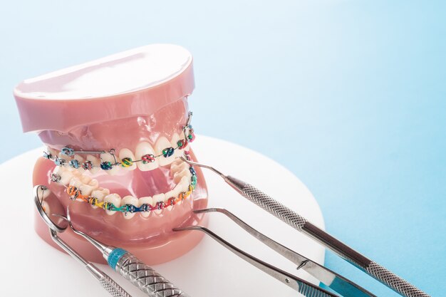 Modèle Orthodontique Et Outil De Dentiste - Modèle De Dents De Démonstration De Variétés De Brackets Ou Orthèses Orthodontiques