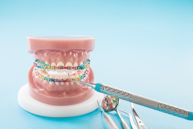 Modèle orthodontique et outil de dentiste - modèle de dents de démonstration des variétés de brackets orthodontiques