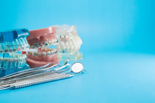 Modèle orthodontique et outil de dentiste