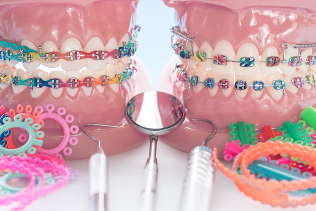 Modèle orthodontique et outil de dentiste