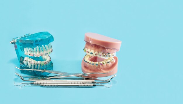 Modèle orthodontique et outil de dentiste