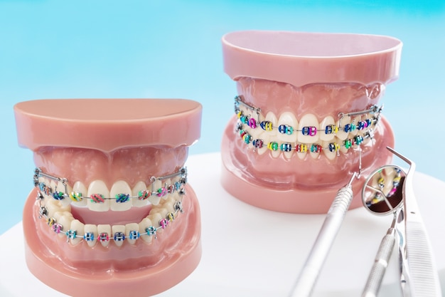 Modèle orthodontique et outil de dentiste