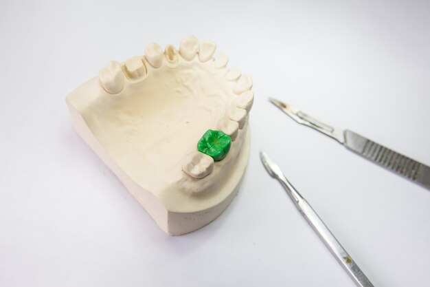 Photo modèles et outils de prothèses dentaires