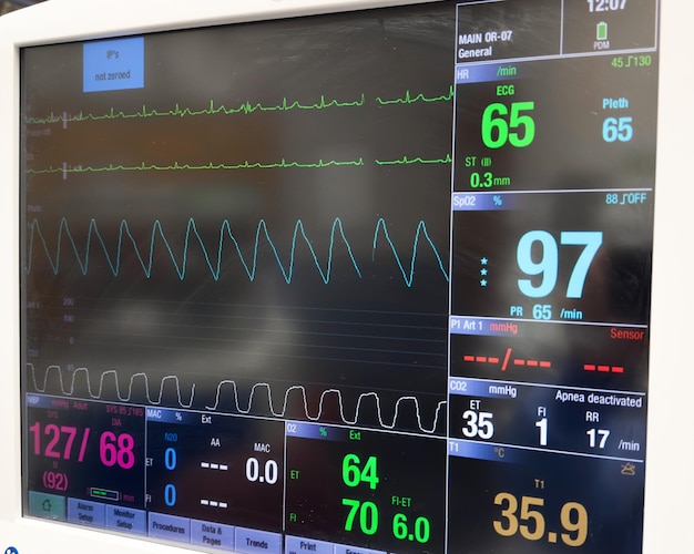 Un moniteur avec un écran qui dit '95 %' dessus