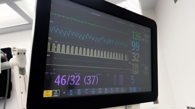 Un moniteur avec un graphique indiquant le temps de 48 : 37.