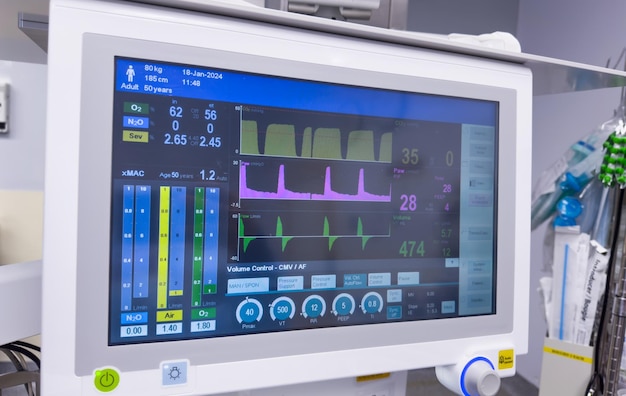 moniteur d'hôpital affichant des signes vitaux mettant l'accent sur la technologie des soins de santé et le bien-être du patient