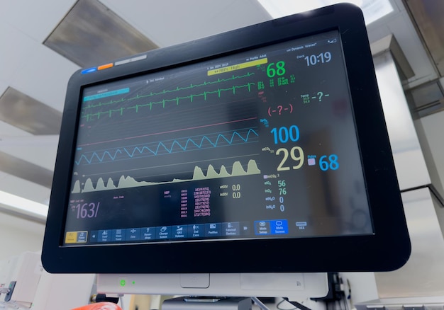 Le moniteur de l'hôpital affiche les signes vitaux, la fréquence cardiaque, la pression artérielle, les niveaux d'oxygène, essentiels pour le patient.