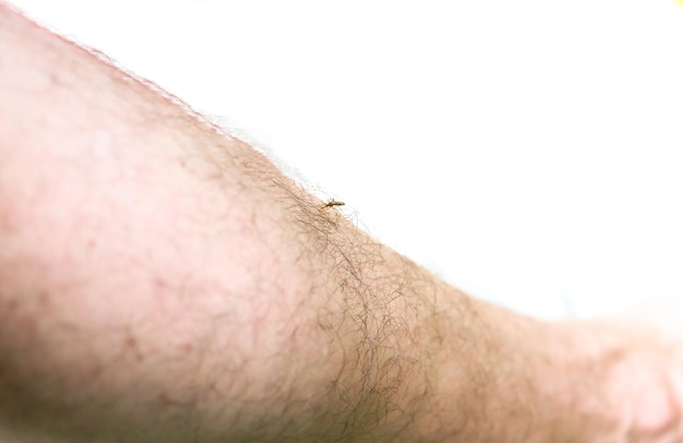 Moustique assis sur la jambe. Les insectes piquent en été. Caractère dangereux. Corps qui démange.