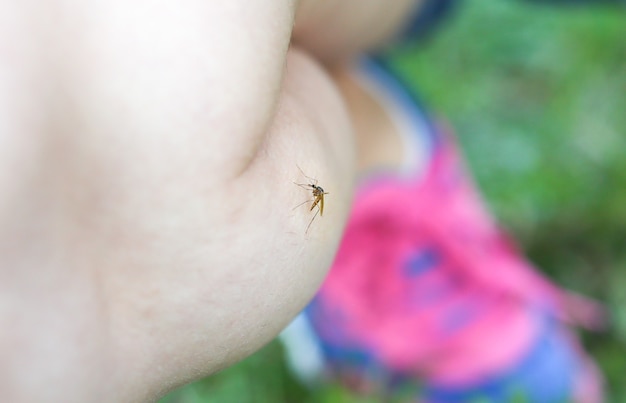 Moustique sur la jambe. L'insecte pique les gens. Problèmes d'été.