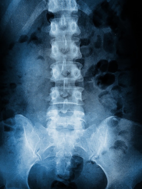 Photo de nombreuses images radiographiques de très bonne qualité